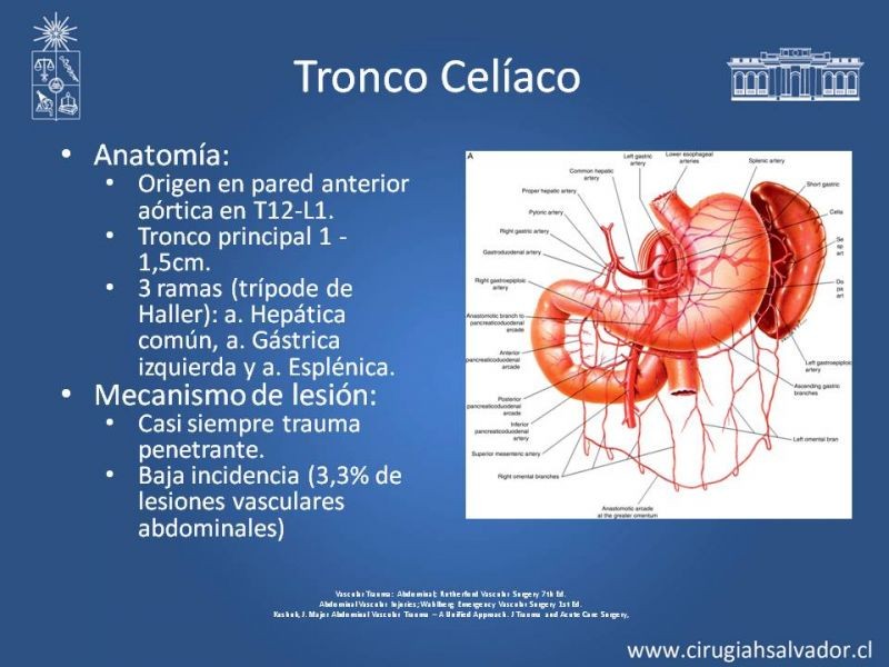 Diapositiva 30 de Trauma Vascular Abdominal