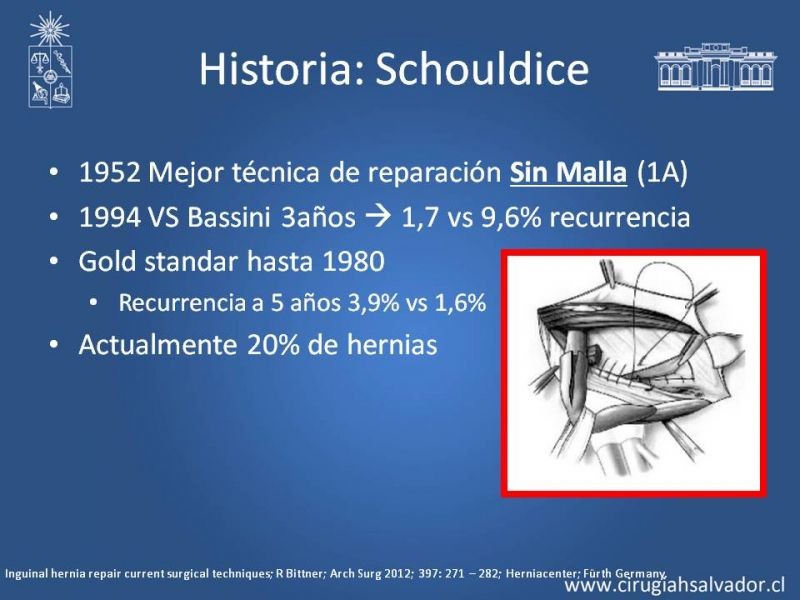 Diapositiva 3 de Hernioplastía Inguinal (Laparoscópica vs Abierta)