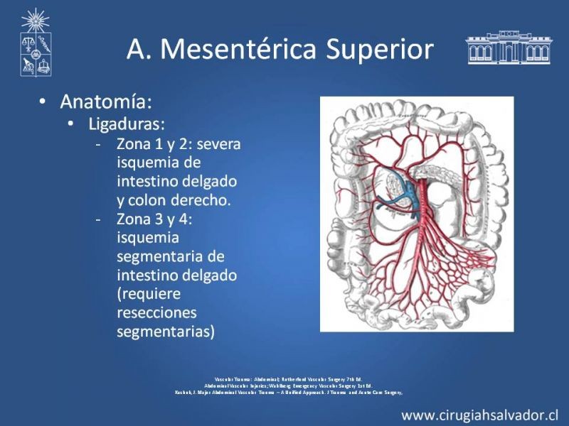 Diapositiva 33 de Trauma Vascular Abdominal