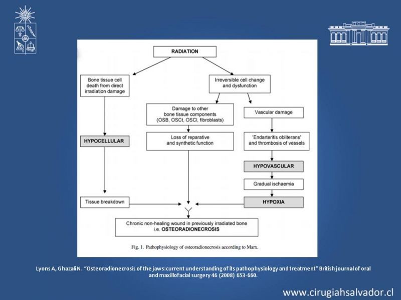 Diapositiva 7 de Osteoradionecrosis