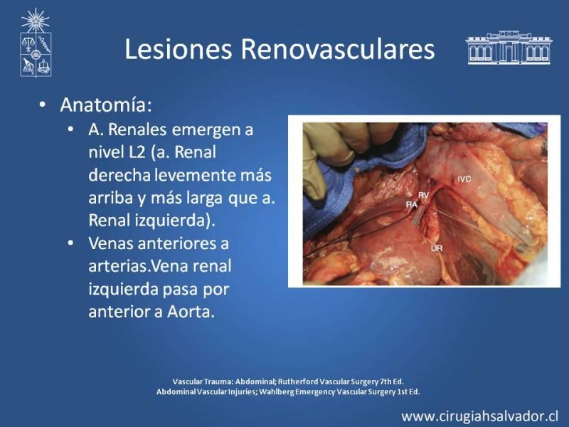 Diapositiva 32 de Lesión Vascular Abdominal