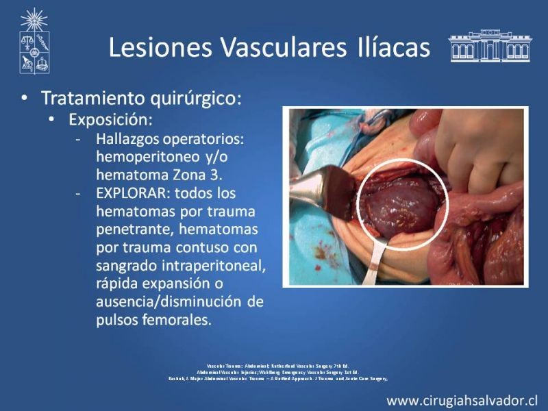 Diapositiva 41 de Lesión Vascular Abdominal