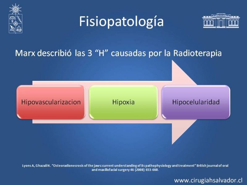 Diapositiva 5 de Osteoradionecrosis