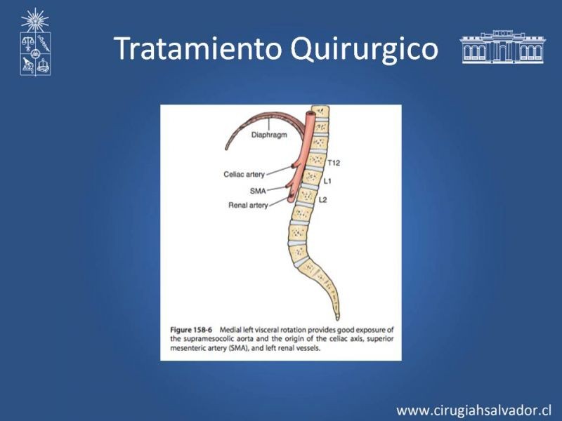 Diapositiva 19 de Lesión Vascular Abdominal