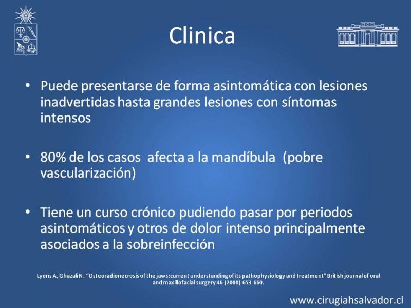 Diapositiva 9 de Osteoradionecrosis
