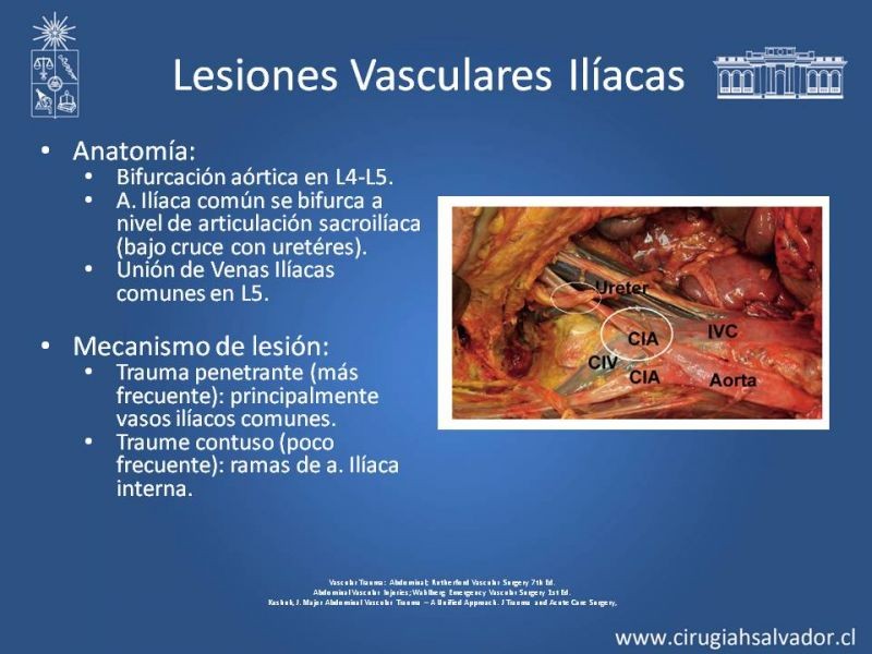 Diapositiva 39 de Lesión Vascular Abdominal
