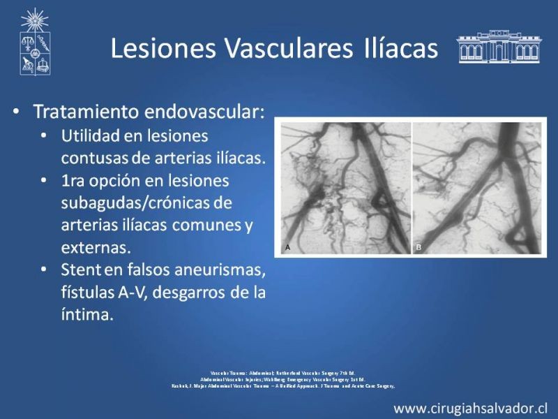 Diapositiva 40 de Lesión Vascular Abdominal