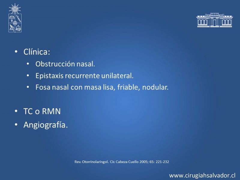 Diapositiva 13 de Tumores de Rinofaringe