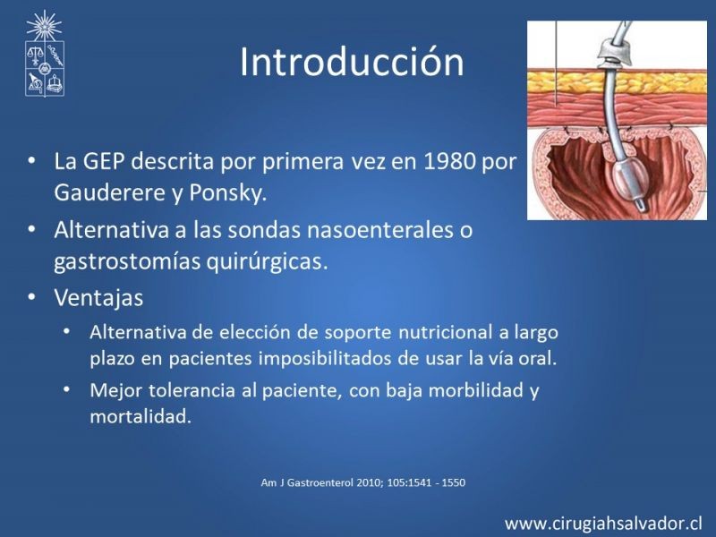 Diapositiva 1 de Gastrostomía Endoscópica Percutánea