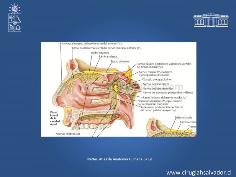 Diapositiva 5 de Tumores de Rinofaringe
