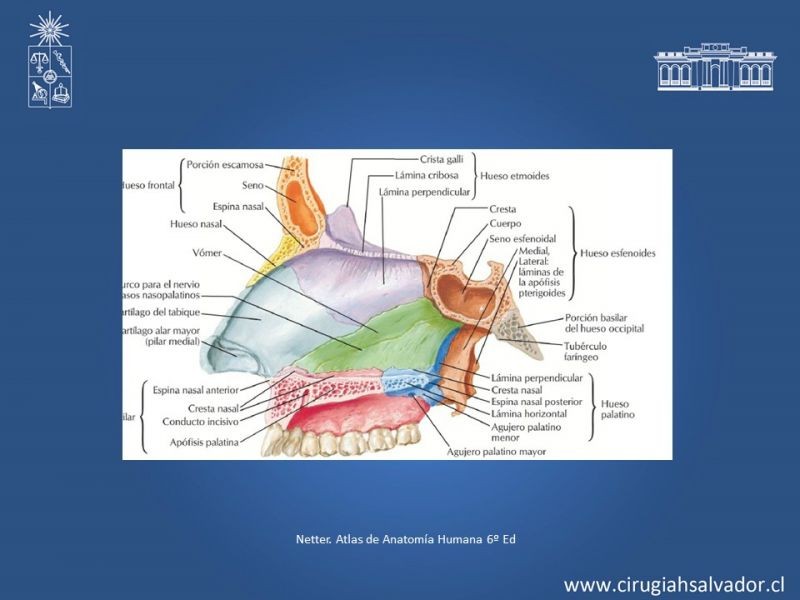 Diapositiva 3 de Tumores de Rinofaringe