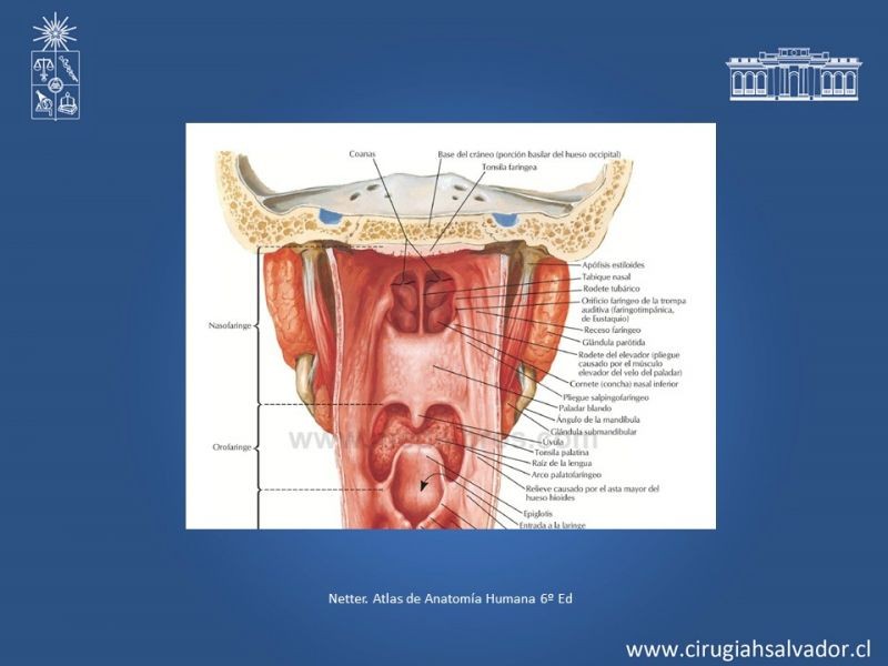 Diapositiva 6 de Tumores de Rinofaringe