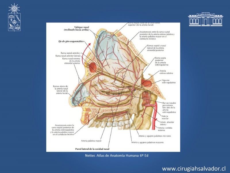 Diapositiva 4 de Tumores de Rinofaringe