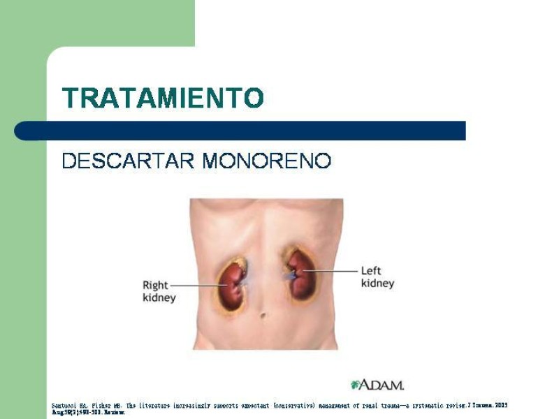 Diapositiva 23 de Traumatismo renal