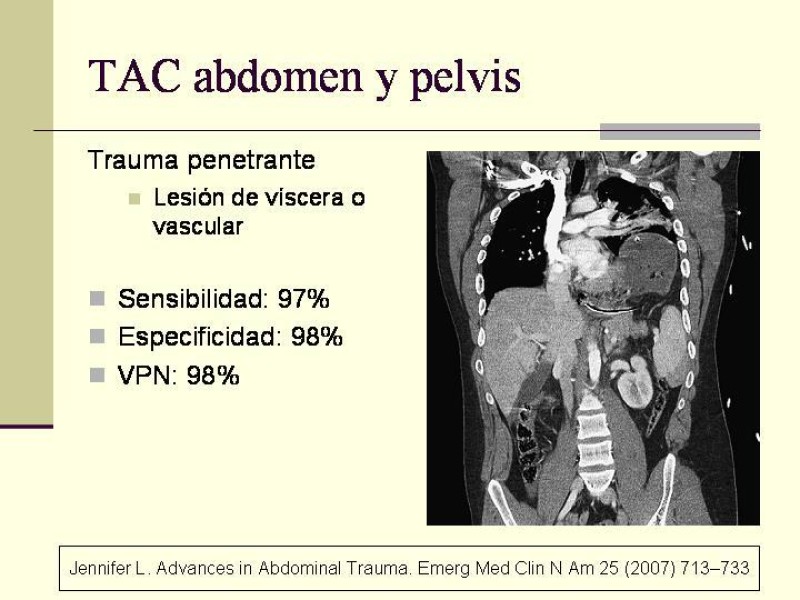 Diapositiva 12 de Lesiones Vasculares Abdominales
