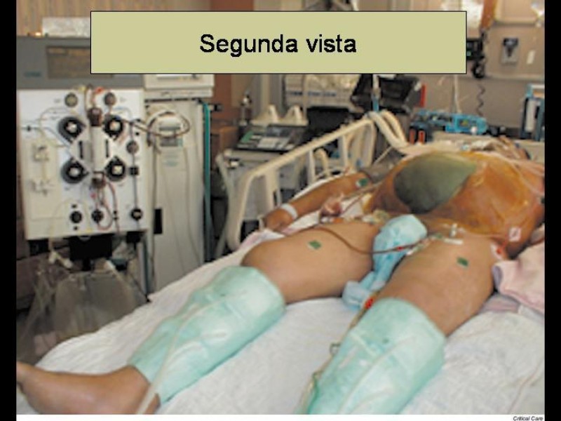 Diapositiva 39 de Lesiones Vasculares Abdominales
