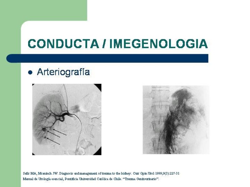 Diapositiva 7 de Traumatismo renal