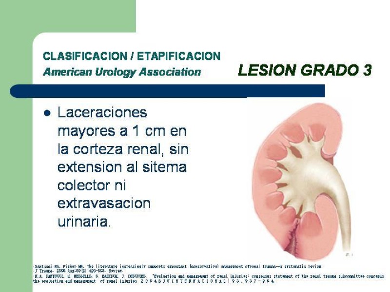 Diapositiva 18 de Traumatismo renal