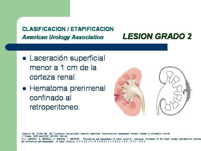 Diapositiva 16 de Traumatismo renal