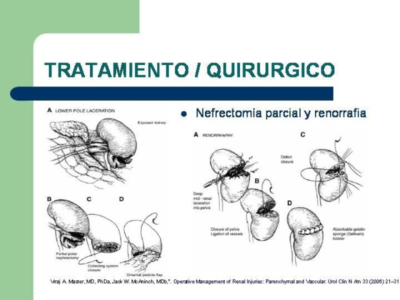 Diapositiva 30 de Traumatismo renal