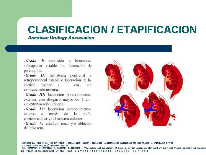 Diapositiva 11 de Traumatismo renal