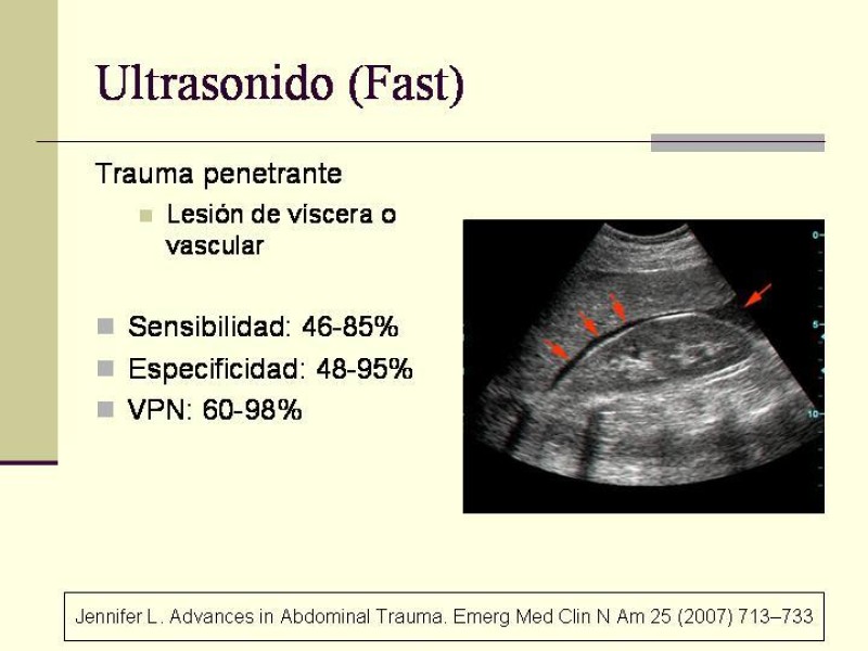 Diapositiva 11 de Lesiones Vasculares Abdominales