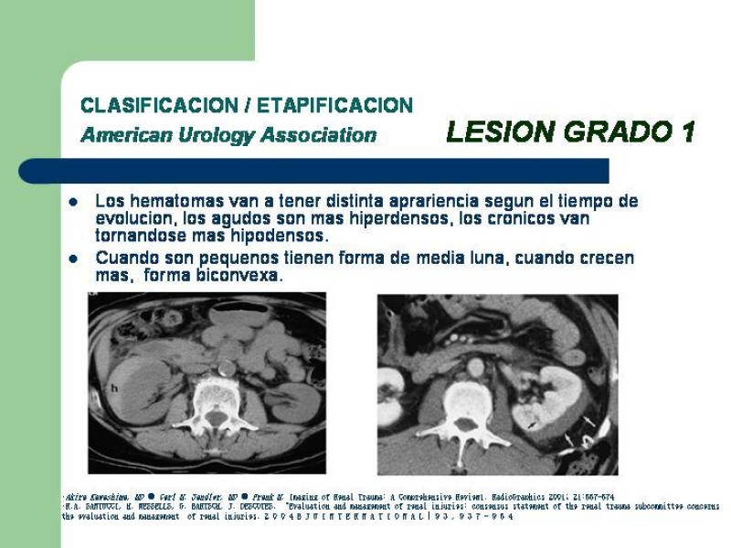 Diapositiva 15 de Traumatismo renal