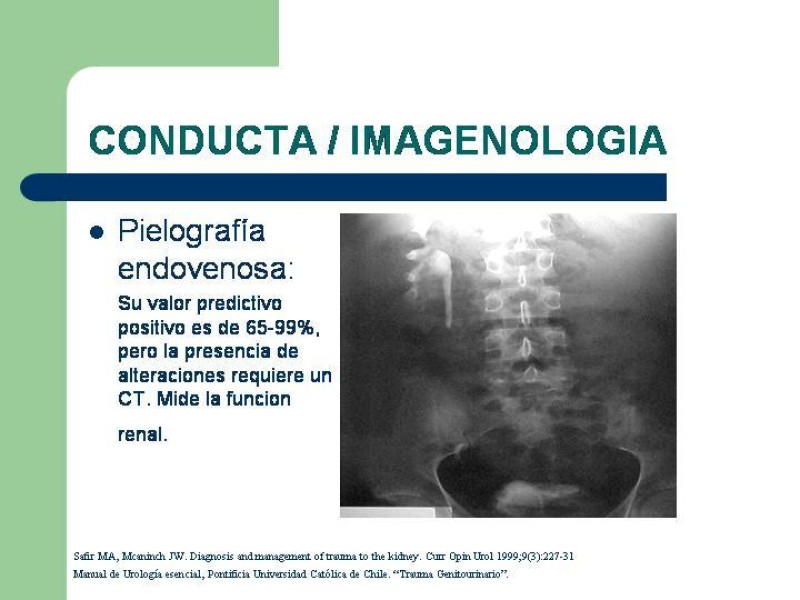 Diapositiva 5 de Traumatismo renal