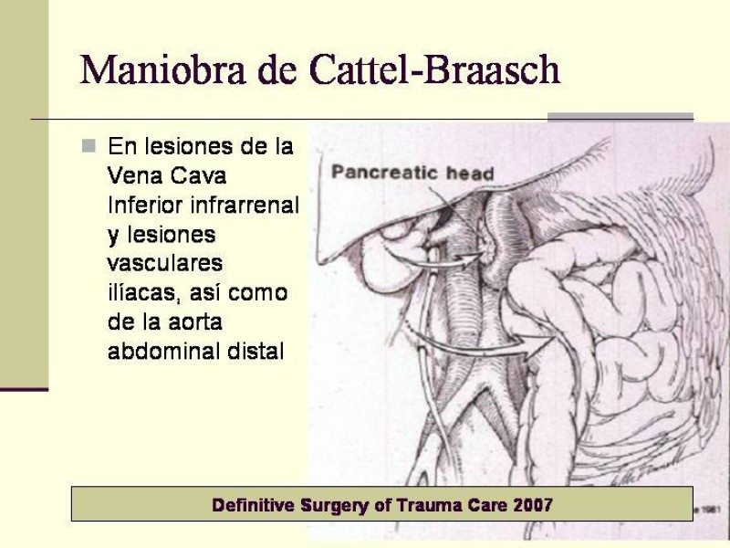 Diapositiva 27 de Lesiones Vasculares Abdominales