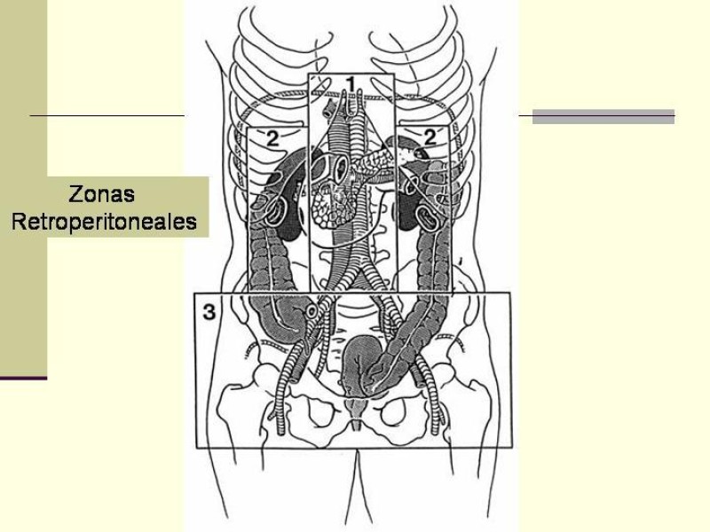 Diapositiva 20 de Lesiones Vasculares Abdominales