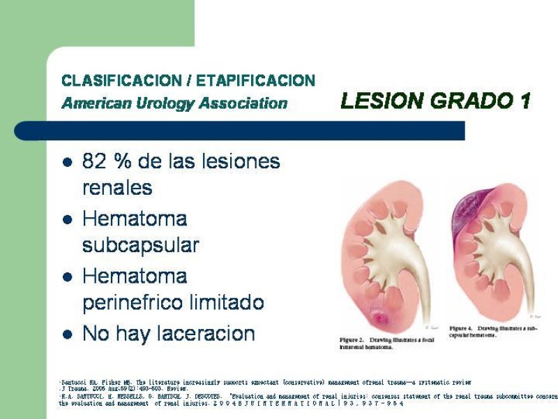 Diapositiva 13 de Traumatismo renal