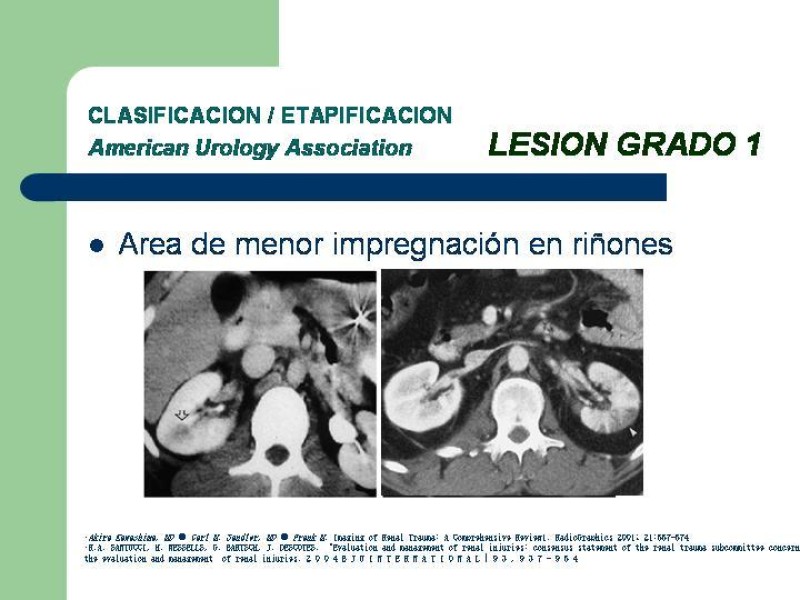 Diapositiva 14 de Traumatismo renal