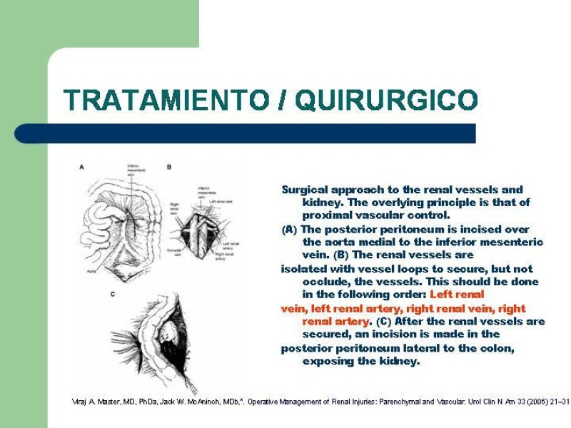 Diapositiva 29 de Traumatismo renal