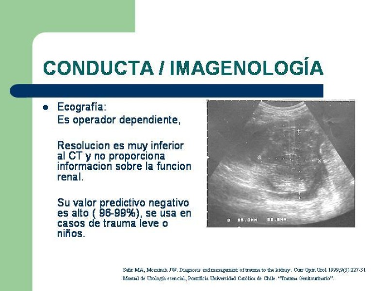 Diapositiva 6 de Traumatismo renal