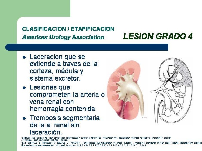 Diapositiva 20 de Traumatismo renal