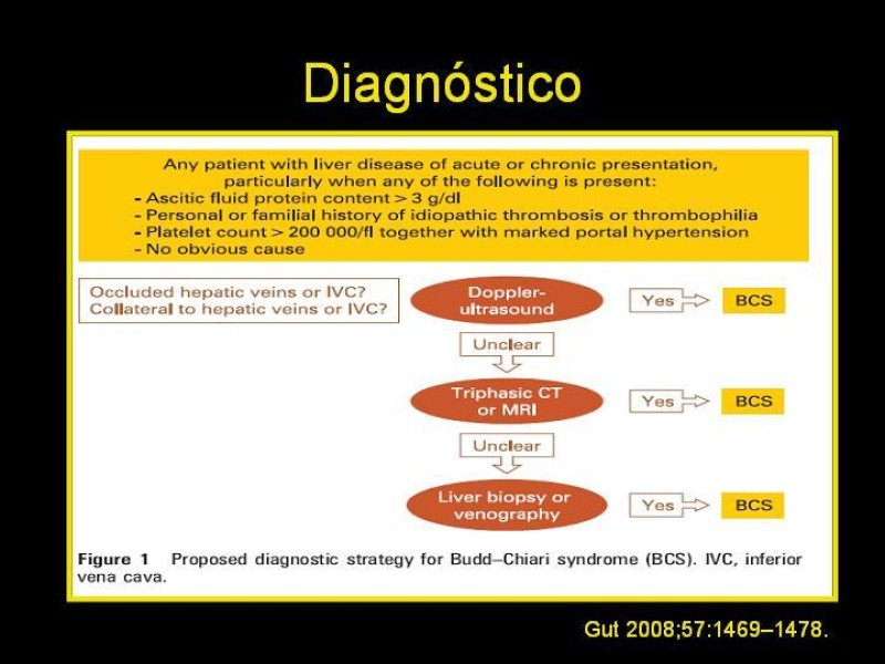 Diapositiva 15 de Sindrome de Budd-Chiari