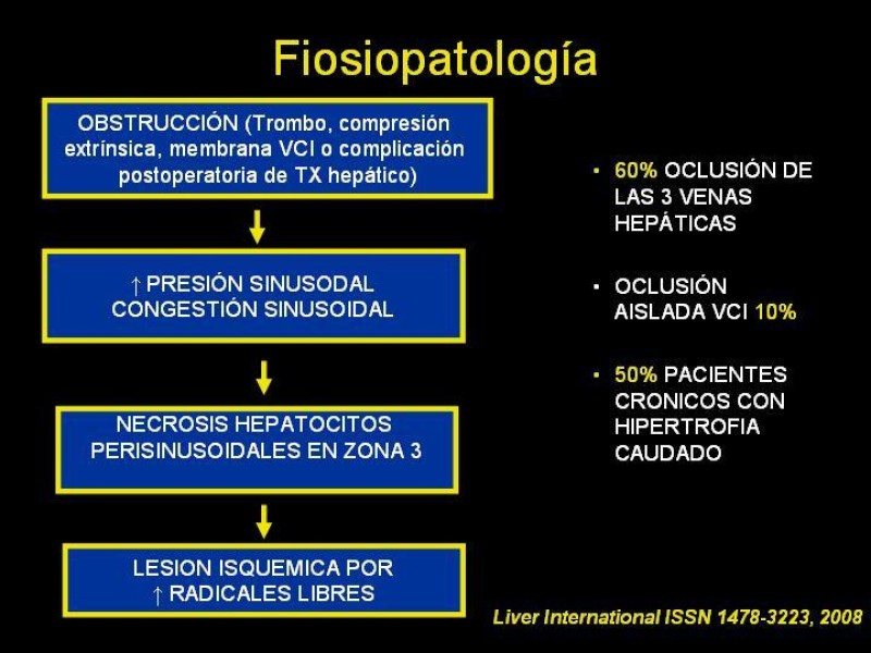 Diapositiva 14 de Sindrome de Budd-Chiari