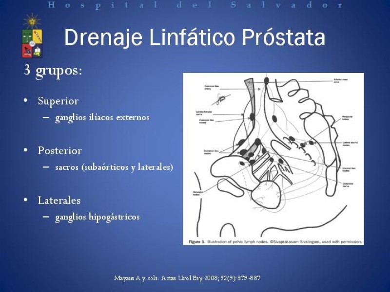 Diapositiva 16 de Linfadenectomía Ampliada vs Estándar en Cáncer de Próstata