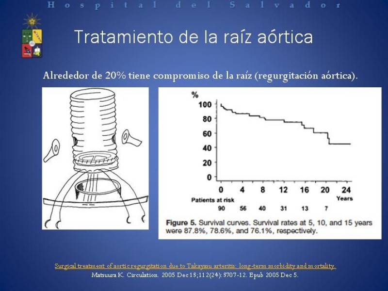 Diapositiva 14 de Enfermedad de Takayasu