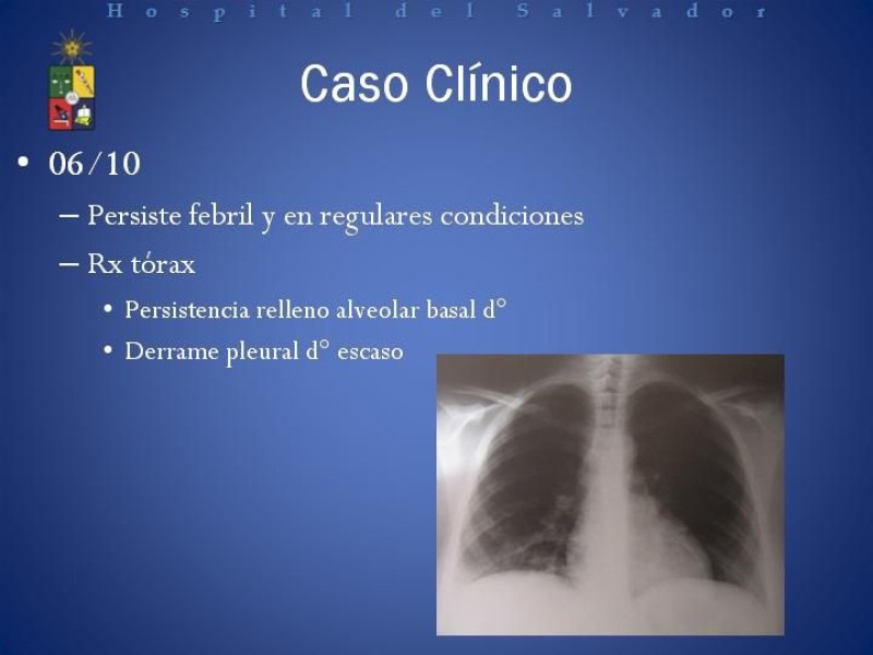 Diapositiva 3 de Manejo de los Abscesos Renales y Perinefríticos a propósito de un caso clínico