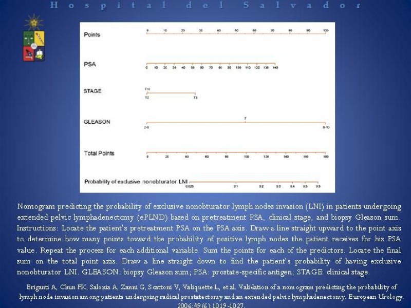 Diapositiva 13 de Linfadenectomía Ampliada vs Estándar en Cáncer de Próstata