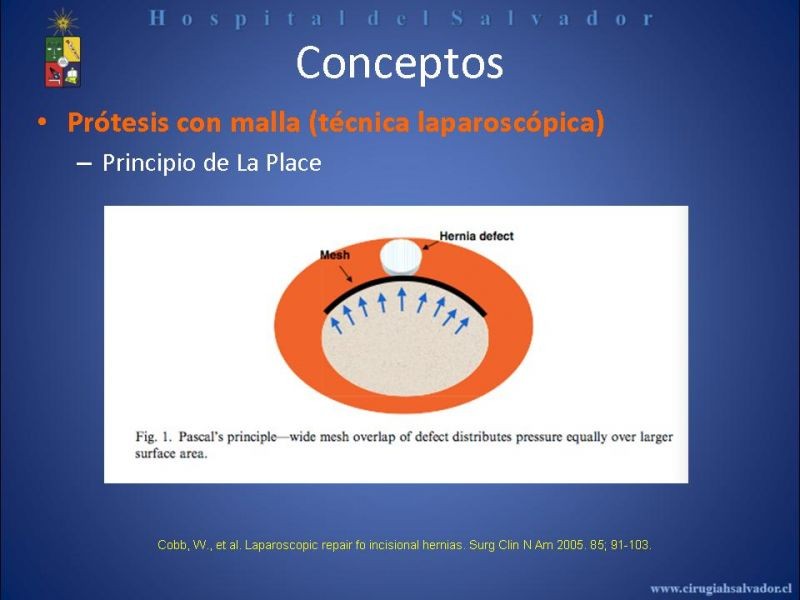 Diapositiva 15 de Reparación Laparoscópica de hernias incisionales