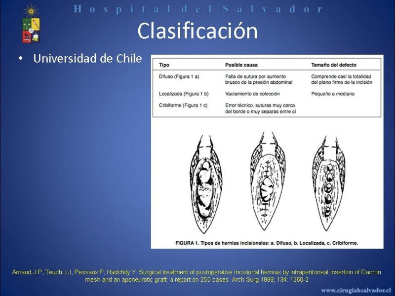 Diapositiva 10 de Reparación Laparoscópica de hernias incisionales