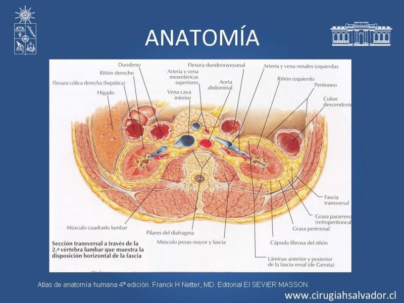 Diapositiva 4 de Nefrectomía técnica quirúrgica