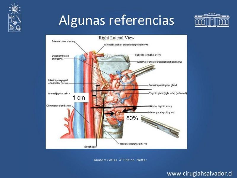 Diapositiva 2 de Hiperparatiroidismo Primario