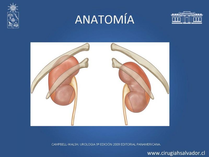 Diapositiva 1 de Nefrectomía técnica quirúrgica