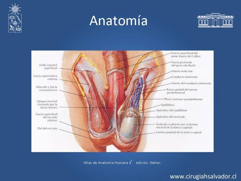 Diapositiva 1 de Escroto Agudo