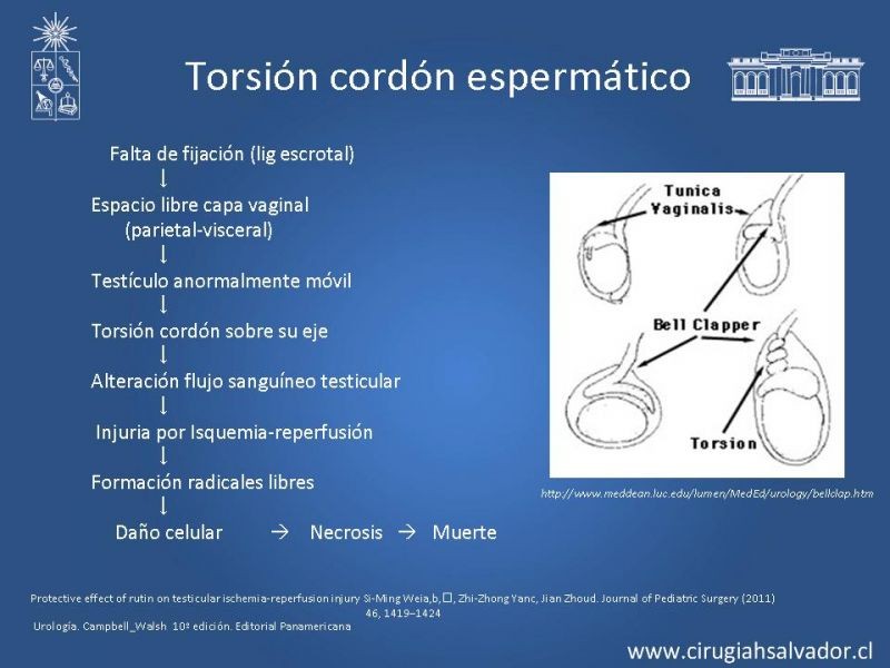 Diapositiva 8 de Escroto Agudo