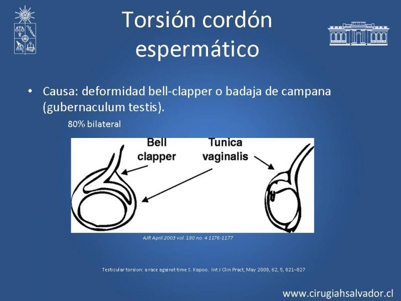Diapositiva 7 de Escroto Agudo