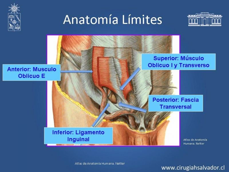 Diapositiva 5 de Alternativas actuales en el tratamiento de la Hernia Inguinal